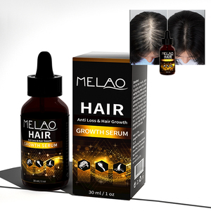 Huile capillaire végétalienne biologique en gros pour renforcer les cheveux, nourrir le cuir chevelu, favoriser la croissance et la réparation des cheveux, et prévenir la chute des cheveux - Product Image 2