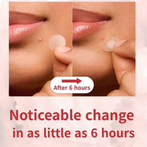 แผ่นแปะสิวไฮโดรคอลลอยด์กันน้ำที่มองไม่เห็นการปรับแต่งแบรนด์โรงงาน - Product Image 3