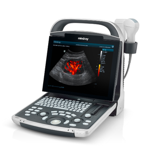 Mindray DP-30 Veterinaire Ultrasone Echografie Machine Digitale Ultrasone Diagnostische Beeldvormingssysteem Veterinaire Draagbare Echografie - Product Image 1