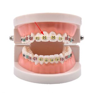 2023 Ortho Elastic O Rings Dental Teeth Braces Bandas de ligadura dental Ligadura de ortodoncia Lazo Blanqueamiento de <span class=keywords><strong>dientes</strong></span> - Product Image 5