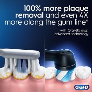 Cepillo de dientes eléctrico recargable Oral-B iO Deep Clean + Protect, negro, serie iO 7, 2 cabezales de repuesto, con estuche de carga - Product Image 4
