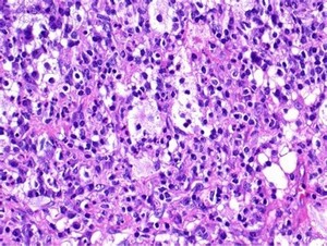 Bestscope BS-2064MH4 <span class=keywords><strong>Infinity</strong></span>修正されたLED照明と計画無色の目的を備えた三眼生物顕微鏡 - Product Image 4
