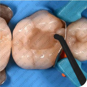 Juego de Instrumentos Dentales Quirúrgicos Manuales de Acero Inoxidable de Alta Calidad, Certificados por la CE, Precio Razonable - Product Image 6