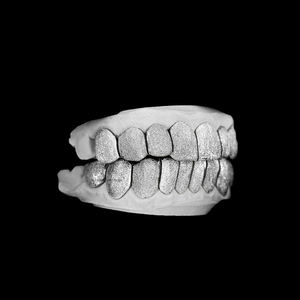 Grillz en or 10K sur mesure, fabriqué à la main, à 6 dents, motif croisé, finition diamantée texturée, pour dents supérieures CONCEPTION GRILLZ17 - Product Image 2