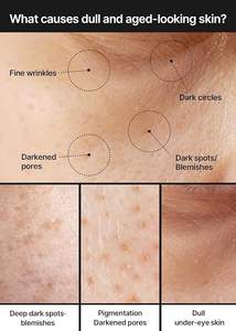 Crema Iluminadora para Poros y Manchas Oscuras 35ml, Minimizador de Poros, Hidratante No Irritante para Piel Sensible, Uso Diario para Mujeres - Product Image 6