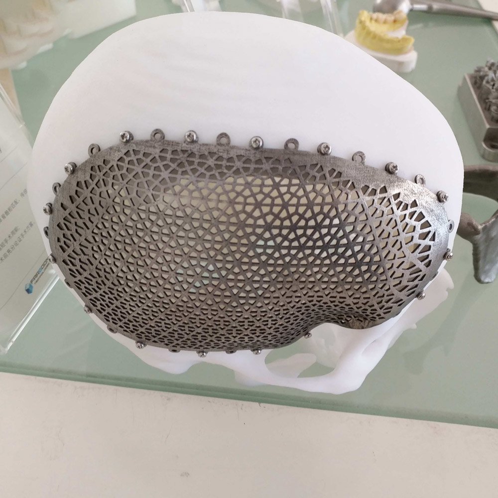 Custom SLM 3d Printing Service - 3D Printing with Metal
