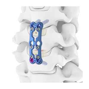 Certifié CE fabricant pakistanais ECO système rachidien implant orthopédique manuel en titane de haute qualité taille personnalisable OEM - Product Image 6