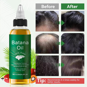 OEM Customized 118ML Herbal Peppermint Argan <b>Oil</b> Organic Anti-Hair Loss Batana <b>Essential</b> <b>Oil</b> for Damaged Curly Hair Natural - Product Image 2