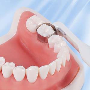 Système d'anneaux à matrice sectionnelle <span class=keywords><strong>dentaire</strong></span> Type de rouleau en acier inoxydable Bandes de ruban à matrice <span class=keywords><strong>dentaire</strong></span> <span class=keywords><strong>Blanchiment</strong></span> des dents - Product Image 2