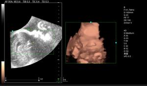 Venta caliente Hospital carro móvil con ultrasonido Doppler color + convexo MSLCU46 - Product Image 6