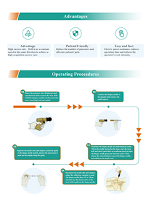 Elektrisch Beenmerg Biopsiesysteem Medisch Botboor Aspiratienaalden Te Koop Chirurgische Apparatuur - Product Image 4