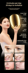 Masker Wajah terapi cahaya 416 tingkat klinis terbaru anti-kerut penggunaan rumah Masker konsentrasi energi tiga Optimal untuk perawatan kecantikan - Product Image 4
