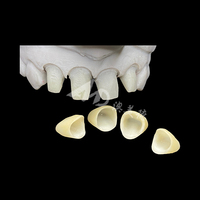 Couronne en zircone de porcelaine E-max à externaliser |   Restaurations dentaires de précision avec technologie E-max et zircone