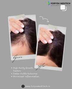 Meilleure Qualité Authentique Cell Bio GFC Gel Tubes Pour La Repousse Des Cheveux Et Contrôle Des Pertes De Cheveux 12mL Tubes À Base De Gel au Prix de Gros - Product Image 2