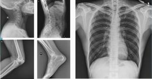Mesin sinar <span class=keywords><strong>X</strong></span> Digital portabel, untuk Diagnosis pencitraan radiografi Panel datar fetektor sinar <span class=keywords><strong>X</strong></span> - Product Image 6