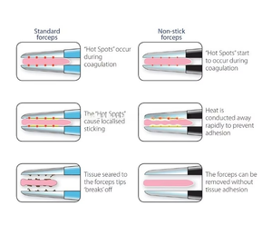 Pinces chirurgicales monopôlaire Potts Smith droites, interrupteur manuel, noires, antiadhésives, avec câble pour chirurgie et hémostase - Product Image 4