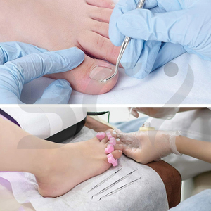 Surgical Stainless Steel Ingrown Toenail <b>Tool</b> <b>Safe</b> Nail Cleaning Treatment Manicure Pedicure <b>Tools</b> Kit Cuticle Pushers - Product Image 6