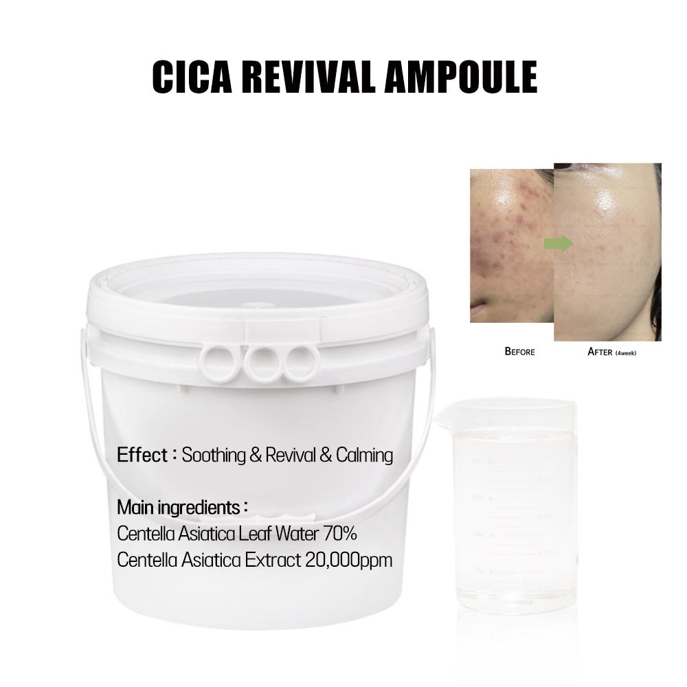 เซรั่มบำรุงผิวหน้า ซิก้า สำหรับผิวเป็นสิว