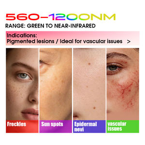 Máquina de Rejuvenecimiento Facial con Filtro Vascular BBL de 5 Estrellas, Eliminación de Capilares y Rosácea - Product Image 4