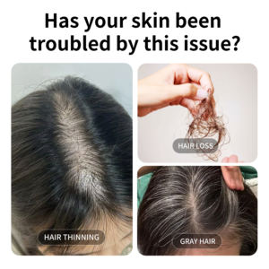 เซรั่มบำรุงเส้นผมไบโอติน |   ทรีทเม้นต์ป้องกันผมร่วงสำหรับผมหงอกบาง ช่วยเสริมสร้างรากผมและกระตุ้นรูขุมขน - Product Image 6