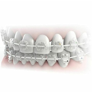 ลวดจัดฟัน Morelli NiTi Superelastic รูปทรงโค้งมน สำหรับขากรรไกรบน - Product Image 4
