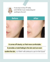 [ROOICELL] Masque modelant pour la peau K-Beauty – Hydratant, liftant et raffermissant pour les pores du visage