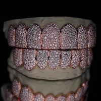 Rejilla Dental Personalizada de Oro Rosa con Diamantes Incrustados para Dientes Superiores e Inferiores, Piedras Simuladas VVS1, Joyería Hip Hop para la Boca