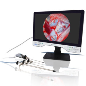 טלפאק 24 אינץ 'fhd צג מסך אנדוסקופ כלי נגינה כירורגיים עבור ארינגוסקופ - Product Image 4