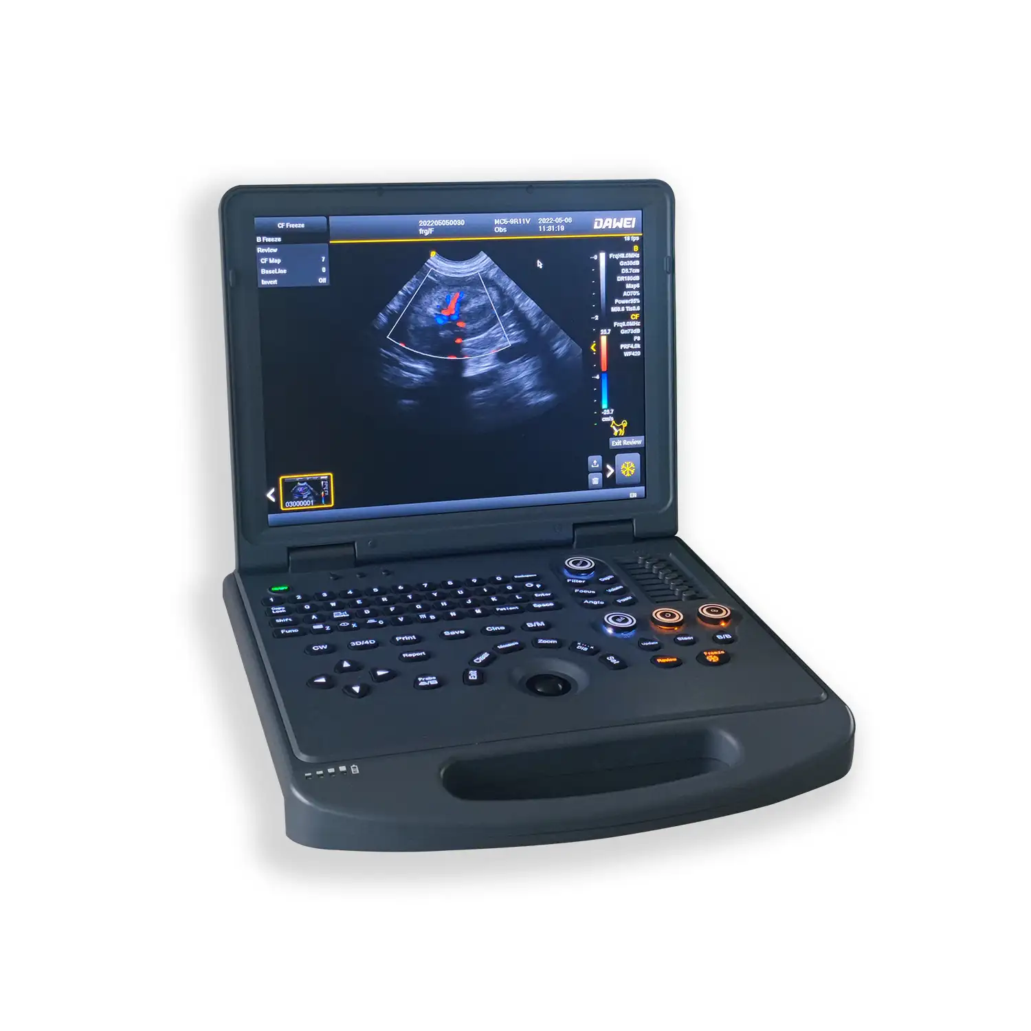 Lap-Top Veterinaire Harmonische Golven Kleur Doppler Ultrasound Imaging Systeem