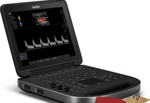 MEJOR PRECIO AL POR MAYOR Y ENTREGA RÁPIDA: Ecógrafo Sonosite EDGE 2 con Sonda Lineal en Venta - Product Image 2