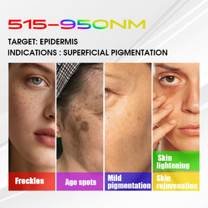 Máquina de Rejuvenecimiento Facial con Filtro Vascular BBL de 5 Estrellas, Eliminación de Capilares y Rosácea - Product Image 5