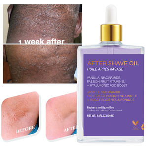 Aceite para Después del Afeitado para <span class=keywords><strong>Mujer</strong></span> de Fresa y Vainilla, Piel Suave, Previene el Vello Enquistado y la Resequedad - Product Image 1