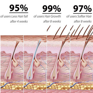 Herbicos Aceite para el cuidado del cabello Romero Jengibre y extracto de hierbas Fortalecimiento de las raíces del cabello Mejora la sequedad Frizz Productos para el cuidado del cabello - Product Image 5