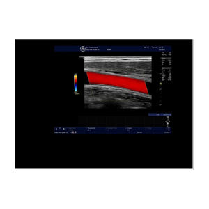 Máquina de Ultrasonido GE LOGIQ V5 Usada - Product Image 6