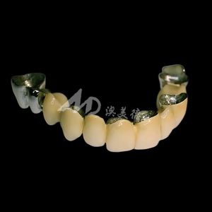 Pont <span class=keywords><strong>dentaire</strong></span> PFM : Conçu avec l'expertise <span class=keywords><strong>dentaire</strong></span>, conçu pour un confort durable - Product Image 2