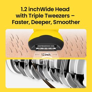 Depiladora Eléctrica Recargable Inalámbrica de 3000V, Pinzas para Depilación Facial y Corporal, Rodillo para Alivio del Dolor, para Mujeres y Hombres, Uso Doméstico - Product Image 6