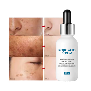 Suero de Ácido Kójico para el cuidado de la piel, crema blanqueadora facial coreana, eliminador de manchas oscuras, marca privada - Product Image 3