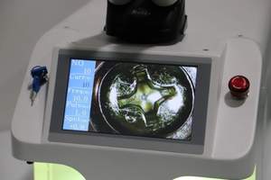 Máquina de Soldadura de Joyería de 60w 100w con Soporte Técnico en Video para Oro, Plata, Cobre, Acero Inoxidable, Yag 100w, Mini Máquina de Soldadura por Puntos - Product Image 3