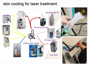 Vücut Soğutma ve Ağrı Giderme için Taşınabilir Zimmer 6 Cilt Soğutma Makinesi - Product Image 5