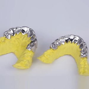 Luxury Hip Hop Iced Out <b>Diamond</b> Grillz Customized 14k 18k White Gold <b>Teeth</b> Grillz VVS Moissanite <b>Diamond</b> Grillz for Men - Product Image 6