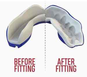 Protège-dents sport personnalisé pour jeunes et adultes Vente en gros Protège-dents pour MMA et boxe - Product Image 6