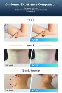 High Quality Inner <b>Massage</b> Roller Cellulite Reduction Weight Loss Body Shape Beer Belly Neck Hump Butterfly Arm Slimming <b>Machine</b> - Product Image 6
