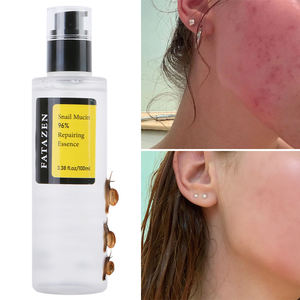 FATAZEN Siero Viso Idratante alla Bava di Lumaca, Essenza Riparatrice alla Mucina di Lumaca, Prodotti di Bellezza per la Cura della Pelle Naturali e Biologici per Potenziare la Pelle - Product Image 5