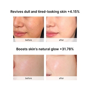 विटामिन सी कैप्सूल सीरम व्हाइटनिंग मॉइस्चराइजिंग त्वचा देखभाल विरोधी चेहरे सीरम - Product Image 2