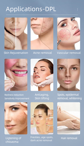 Đa chức năng cho DPL máy cho cơ thể mặt Phương pháp điều trị đỏ giảm Lọc nhắm mục tiêu tóc khác nhau và các loại da - Product Image 6