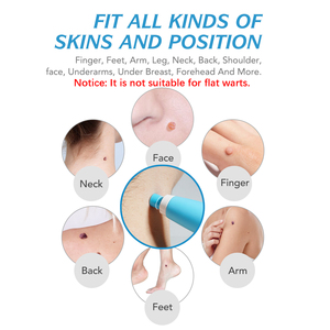 Kit de Eliminación de <span class=keywords><strong>Verrugas</strong></span> Cutáneas ALIVER Directo de Fábrica, Servicio OEM 2 en 1 <span class=keywords><strong>para</strong></span> <span class=keywords><strong>Verrugas</strong></span> Cutáneas Medianas y Grandes, Empaque Personalizado Disponible, Envío Rápido - Product Image 3