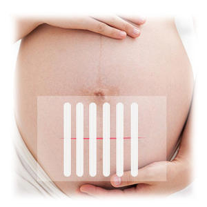 แถบผ้า R1547ยืดหยุ่น R1546 6มม. x 75มม. 50แพ็คผสมโทนกาวในตัวแถบผ้าใยสังเคราะห์ปิดแผลทางการแพทย์ - Product Image 2