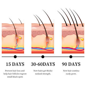 MOIKA Tratamento Capilar Personalizado 100% Natural Orgânico Eficaz Contra Queda de Cabelo Óleo de Crescimento com Biotina e Óleo Essencial de Alecrim - Product Image 4