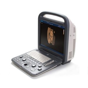 Máquina de Ultrasonido SonoScape S2 - Product Image 1