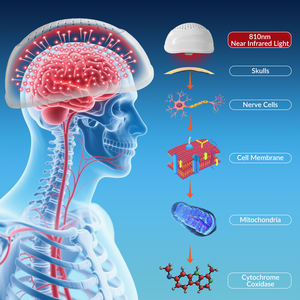 Casco per Fototerapia per Uso Domestico e Clinico, per Alleviare Disturbi del Sonno, Cattiva Funzione Cognitiva e Nebbia Cerebrale - Product Image 3